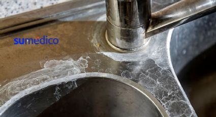 Cómo limpiar el fregadero para quitar manchas y dejarlo como nuevo
