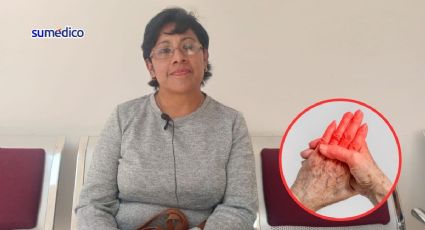 Elena trata la artritis reumatoide con homeopatía; así funciona