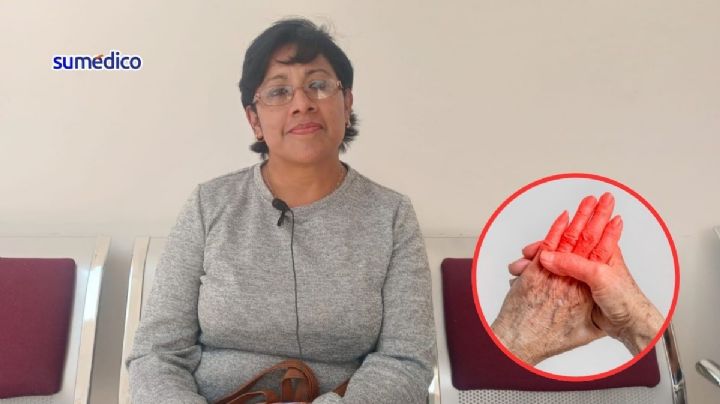 Elena trata la artritis reumatoide con homeopatía; así funciona