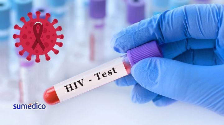 La nueva prueba de detección de VIH que puedes hacer desde casa