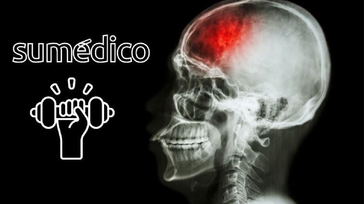 Estos son los ejercicios que ayudan a reducir el riesgo de ictus