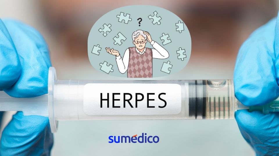 La vacuna contra el herpes puede retrasar la demencia