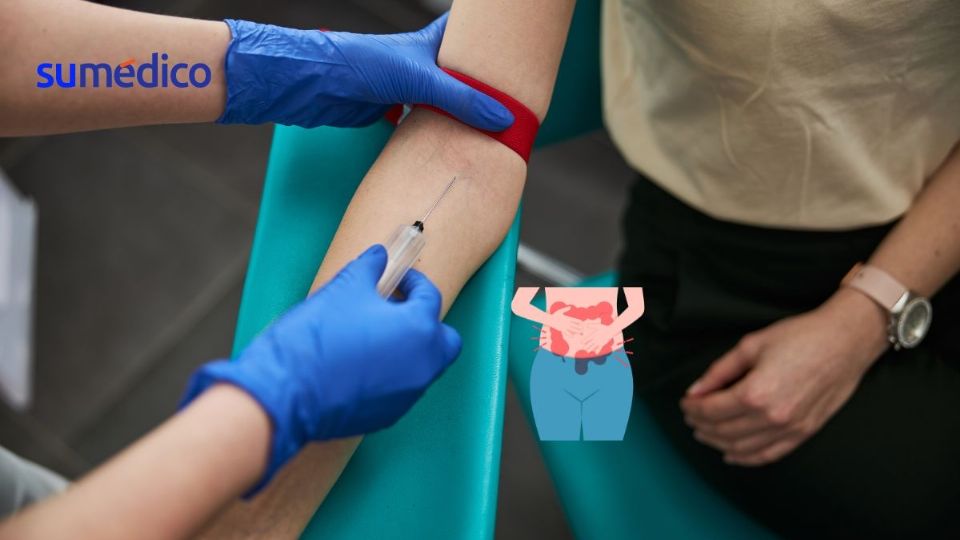 La prueba de sangre puede ayudar a detectar el cáncer de colon