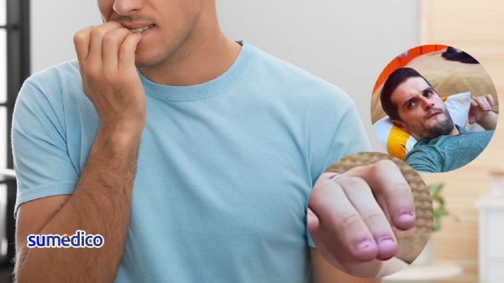 ¿Cuál es el padecimiento que te hace morderte las uñas, como Adrián Marcelo?