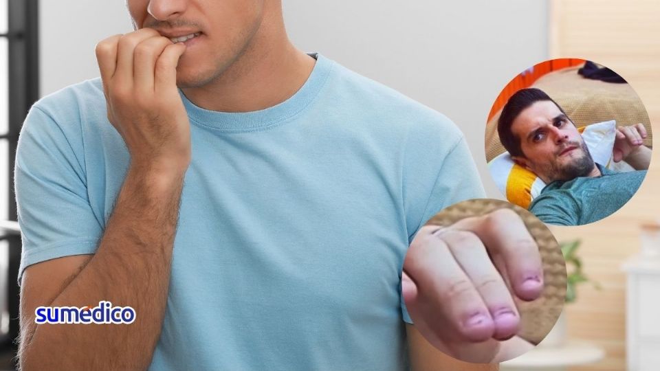 Morderse las uñas oculta problemas para manejar las emociones.