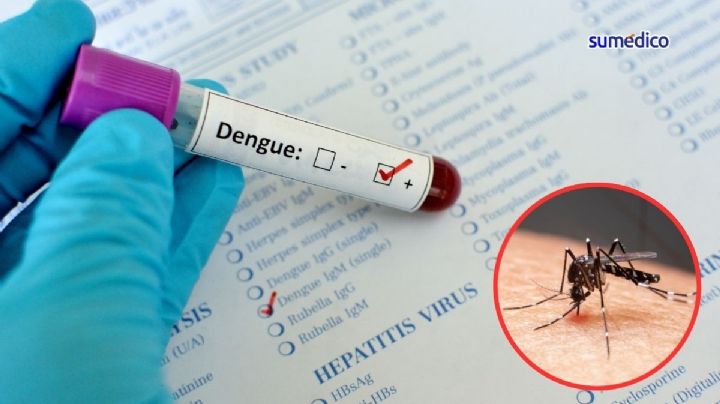 Dengue creció en México más de 500%; vacunación e higiene, claves de mitigación