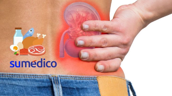 ¿Qué es el oxalato y por qué pone en riesgo tus riñones?