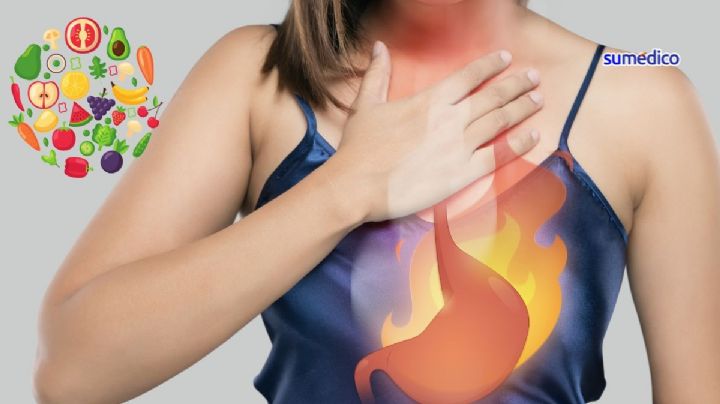 ¿Qué alimentos ayudan a eliminar el ardor del estómago?