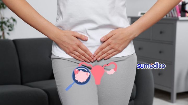 “Los doctores decían que el dolor pélvico era parte de ser mujer, resultó ser cáncer”