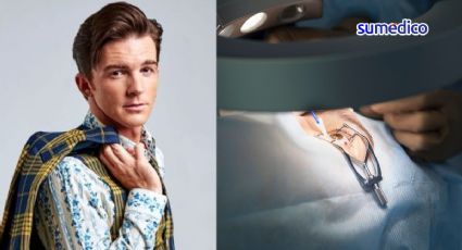 ¿En qué consiste la cirugía de ojos LASIK como la de Drake Bell?