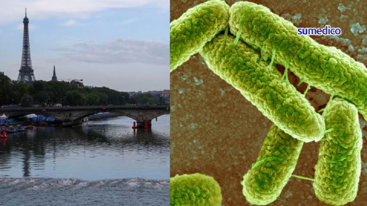 ¿Qué es E.Coli, bacteria por la que una atleta de Juegos Olímpicos fue hospitalizada?