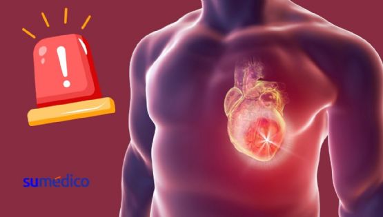 El protocolo para atender un infarto al corazón en menor tiempo