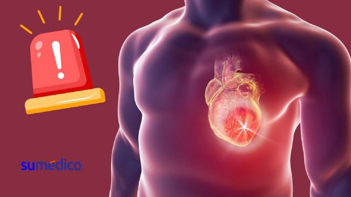 El protocolo para atender un infarto al corazón en menor tiempo