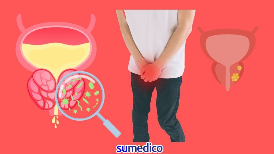 La próstata puede padecer diferentes enfermedades, no solo cáncer