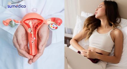 La endometriosis se puede atender en una clínica especializada