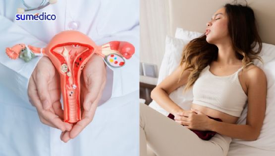 La endometriosis se puede atender en una clínica especializada