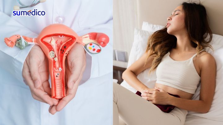 La endometriosis se puede atender en una clínica especializada