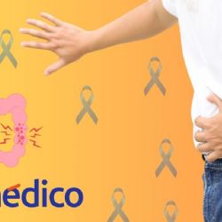 ¿Qué es el cáncer de colon y por qué afecta más a jóvenes?