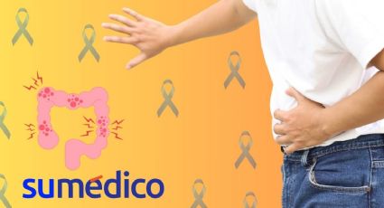 ¿Qué es el cáncer de colon y por qué afecta más a jóvenes?