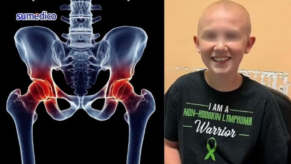 Landon fue diagnosticado con un raro tipo de cáncer en la sangre.