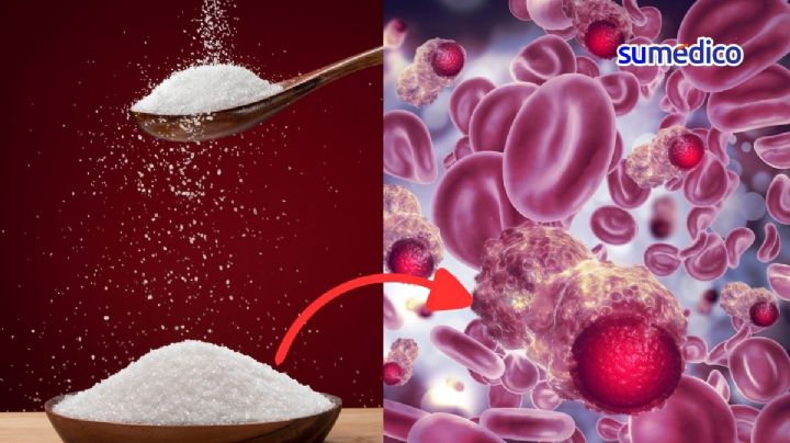 ¿Consumir mucha azúcar puede causar cáncer?