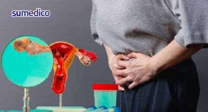 ¿Qué síntomas da el cáncer de ovario? 5 señales que NO debes ignorar