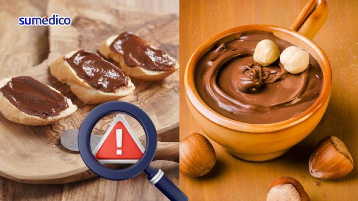La crema de avellana que es alta en grasas y tiene un potencial cancerígeno