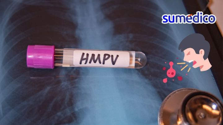 ¿Qué síntomas da el virus Metapneumovirus Humano y por qué causa alerta?