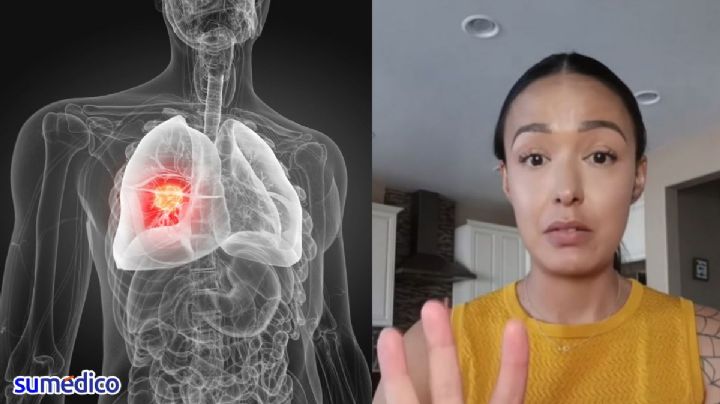 'Los doctores dijeron que era alergia, pero tenía cáncer de pulmón a mis 34'