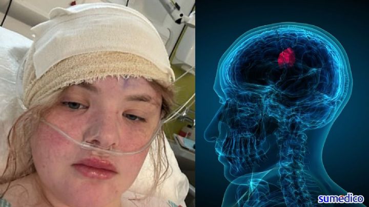 "Tenía dolor de cabeza en el embarazo, me detectaron un tumor cerebral justo antes de dar a luz"