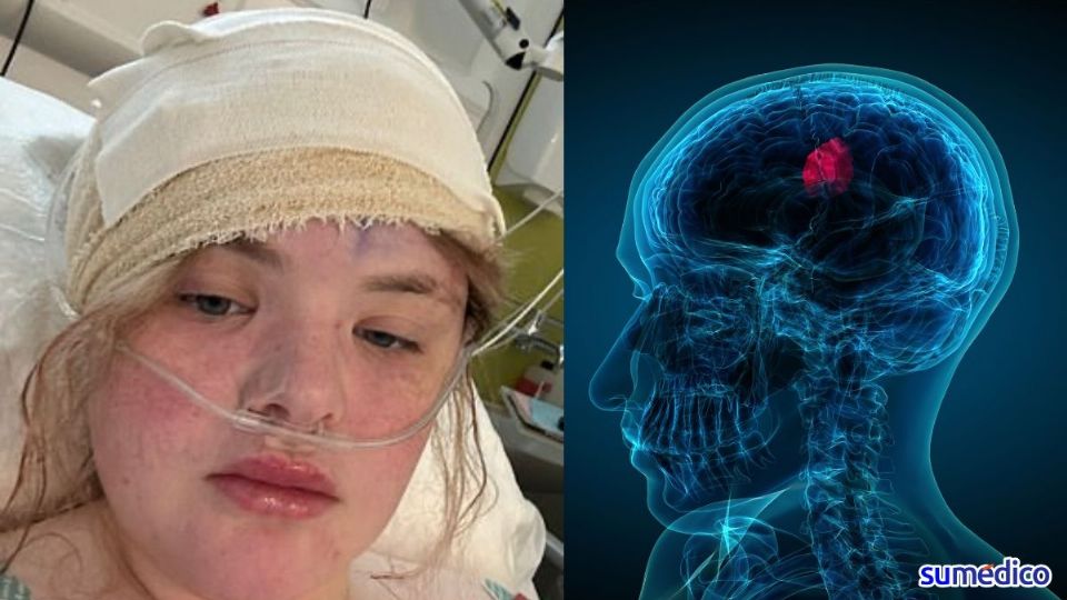 Los dolores de cabeza la llevaron al hospital en marzo de 2024. Los estudios revelaron un tumor cerebral.