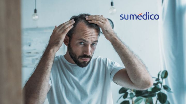 ¿Cuáles son las causas comunes por las que se cae el cabello?