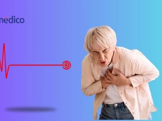 Infarto: 8 estrategias clave para prevenirlos, según especialistas