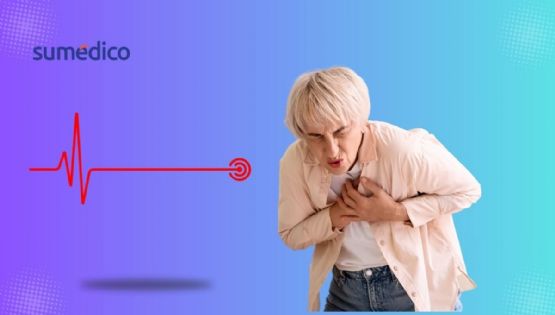 Infarto: 8 estrategias clave para prevenirlos, según especialistas