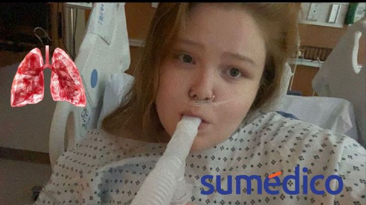 ‘Cambié el cigarro por vape, ahora tengo una rara enfermedad pulmonar’