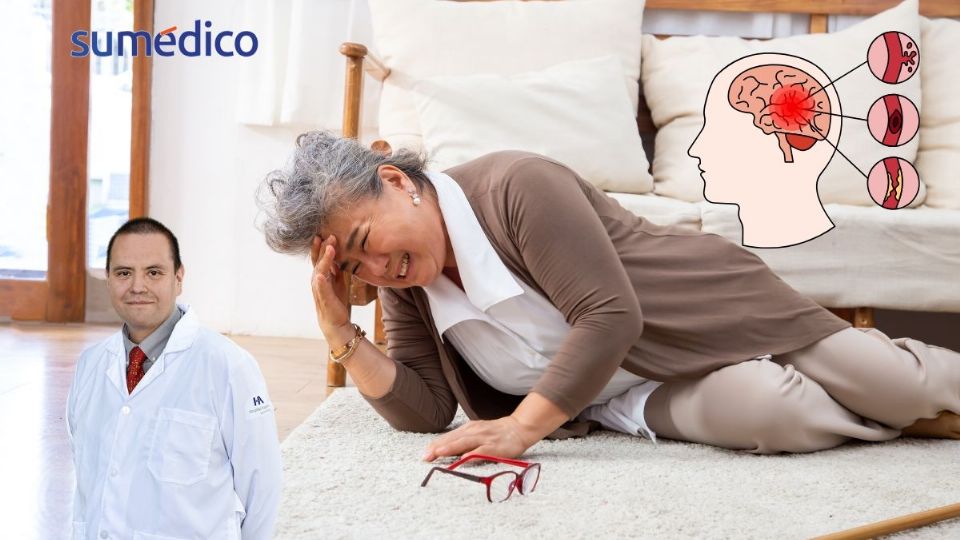 Es importante saber diagnosticar un ictus