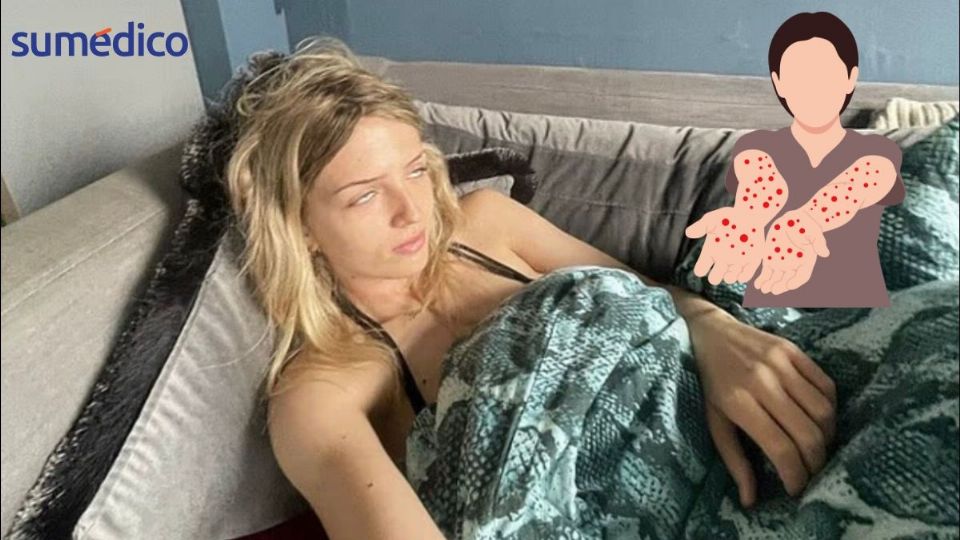 Indigo Duffy, una joven de 22 años fue diagnosticada con una vieja enfermedad