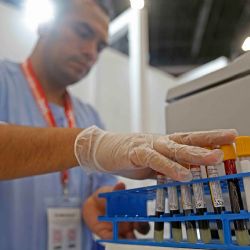 Lp(a), predisposición genética de males cardiácos