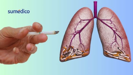 Hombres fumadores tienen mayor riesgo de cáncer de vejiga, revela estudio