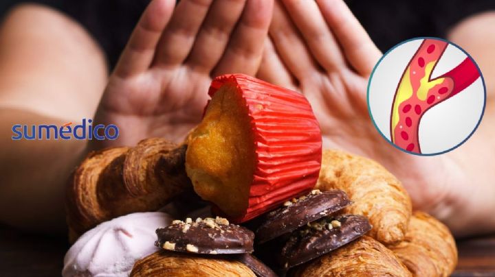 Los alimentos que NO debes comer si tienes colesterol alto