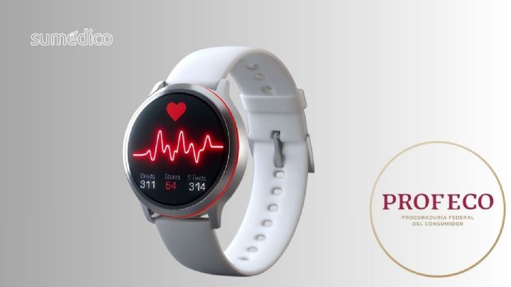 ¿Cuál es el mejor smartwatch para tu salud, según Profeco?