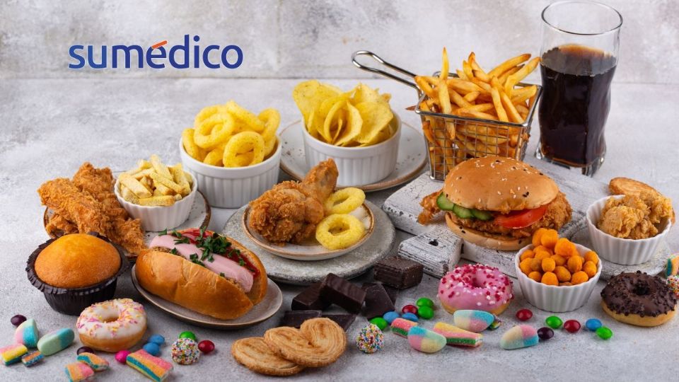 Conoce los alimentos que dañan tu salud intestinal y que NO debes consumir en el desayuno