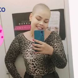 Influencer ignoró síntomas de salud y ahora revela que padece un raro cáncer
