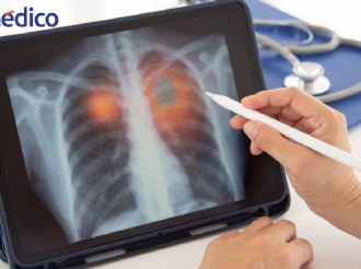 Aumentan casos de neumonía en plena temporada de frío