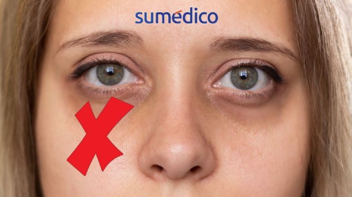 5 trucos que ayudan a eliminar las ojeras de manera natural