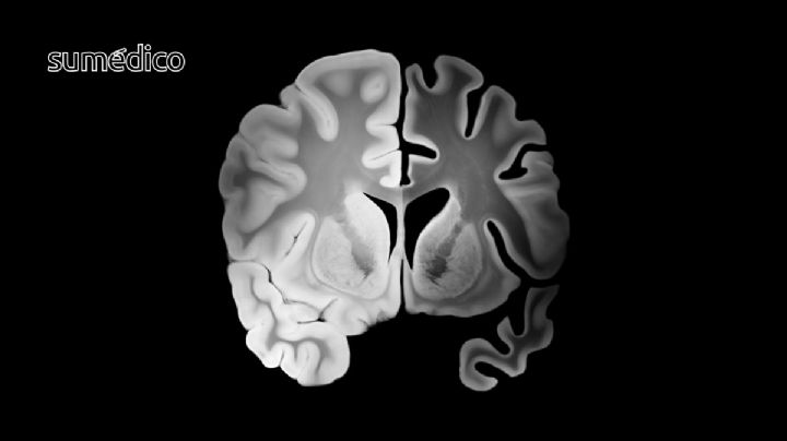 ¿Cómo debo tratar con un familiar con Alzheimer? Consideraciones y cuidados