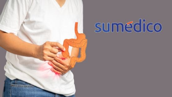 ¿Qué es la colitis y cuáles son sus síntomas?