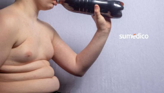 El azúcar que enfermó a México: así ha crecido la diabetes en el país