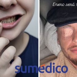 ¿Qué es una parálisis facial cómo la que sufrió Lucas Ocampos jugador del Monterrey?