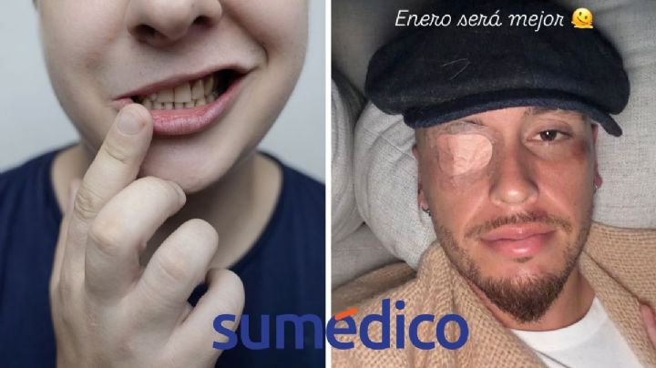 ¿Qué es una parálisis facial cómo la que sufrió Lucas Ocampos jugador del Monterrey?